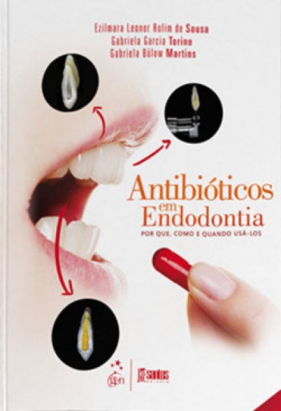 Antibióticos Em Endodontia - Por Que, Como E Quando Usá-Los