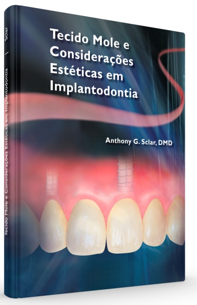 Tecido Mole E Considerações Estéticas Em Implantodontia