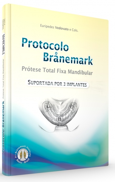 Protocolo Branemark Prótese Total Fixa Mandibular Suportada Por 3 Implantes