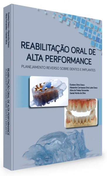 Reabilitação Oral De Alta Performance: Planejamento Reverso Sobre Dentes E Implantes