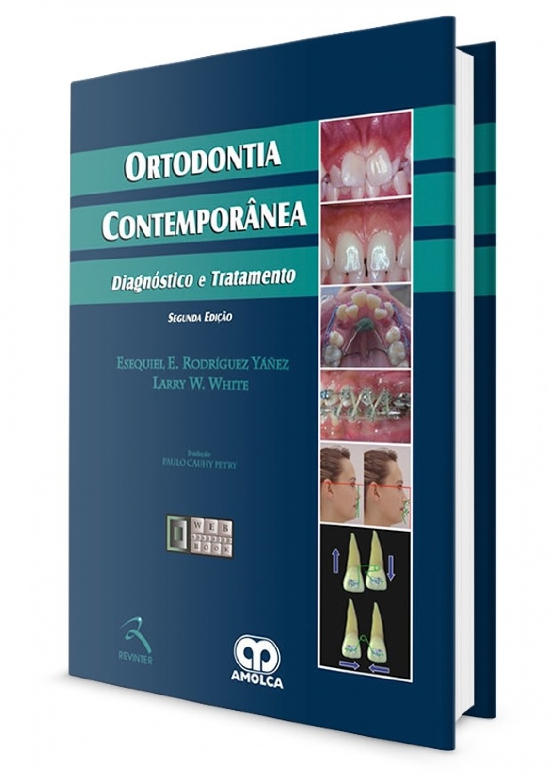 Ortodontia Contemporânea - Diagnóstico E Tratamento