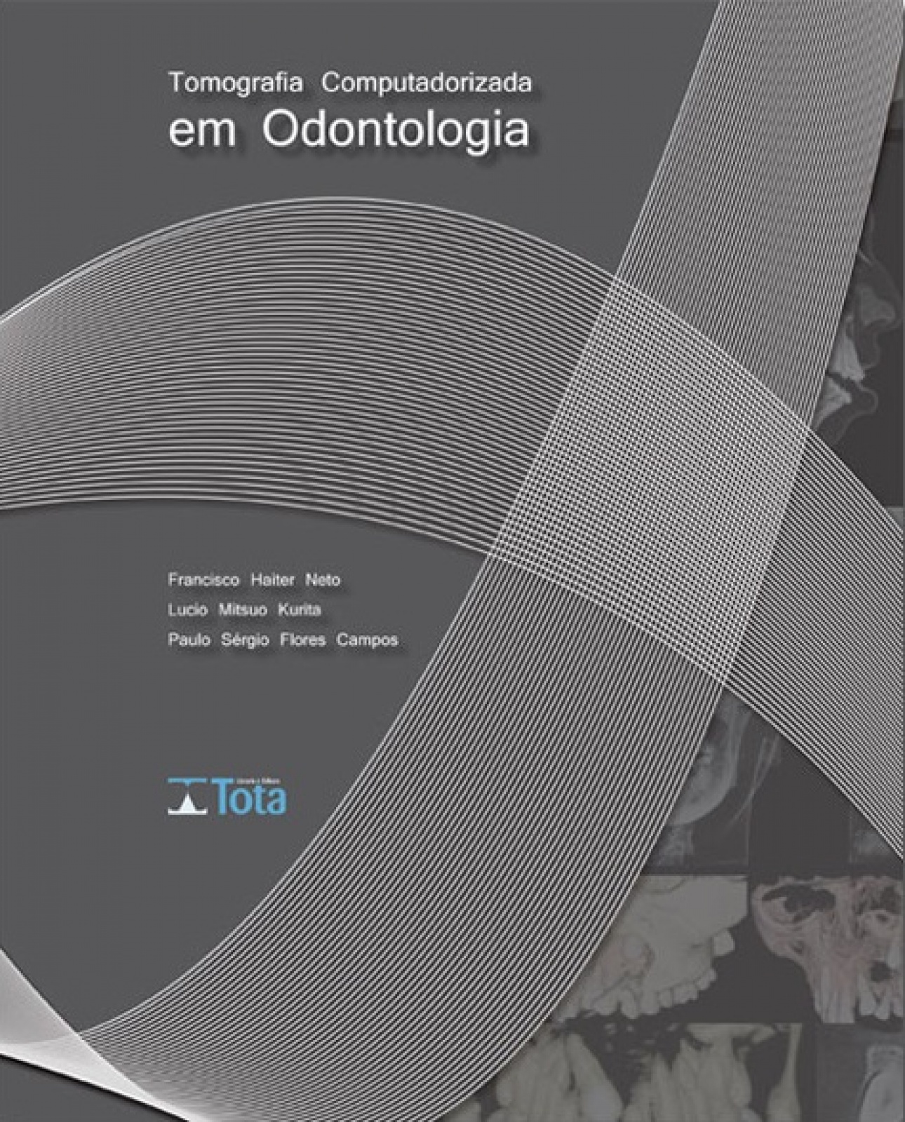 Tomografia Computadorizada Em Odontologia