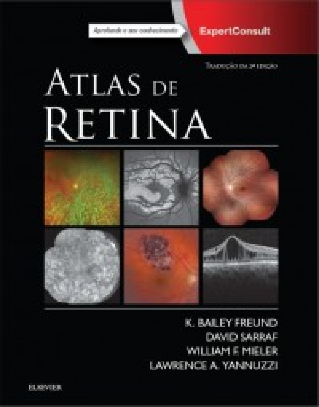 Atlas De Retina- 2A Edição