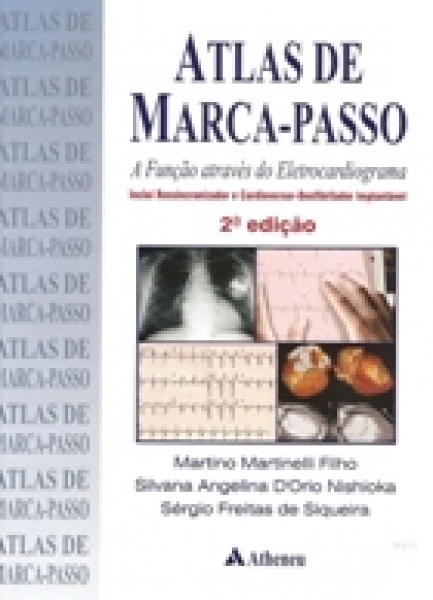 Atlas De Marcapasso 