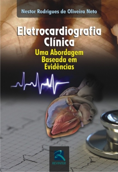Eletrocardiografia Clínica - Uma Abordagem Baseada Em Evidências