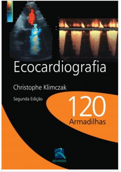 Ecocardiografia 120 Armadilhas