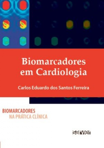Biomarcadores Em Cardiologia