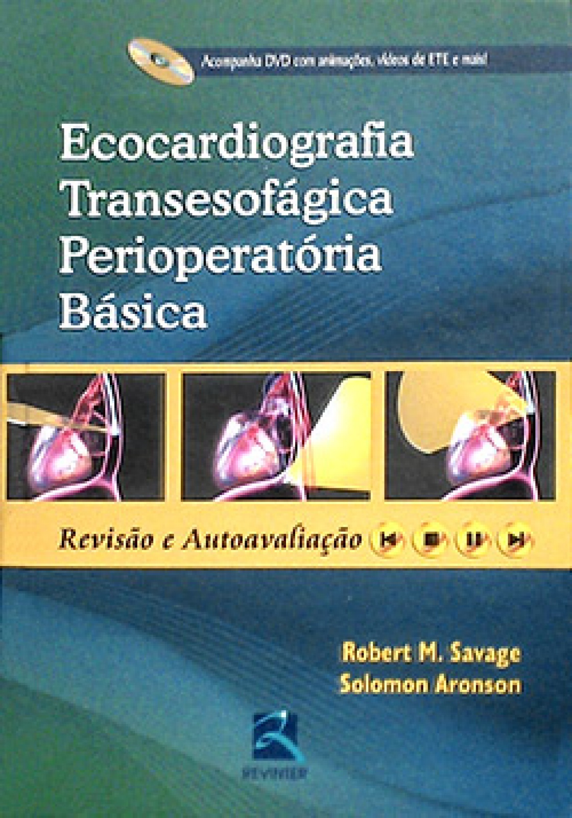 Ecocardiografia Transesofágica Perioperatória Básica