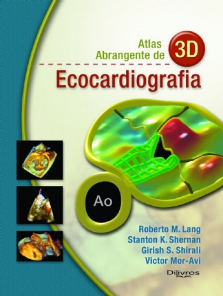 Atlas Abrangente De 3D - Ecocardiografia