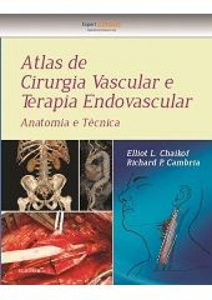Atlas De Cirurgia Vascular E Terapia Endovascular - 1ª Edição 2016