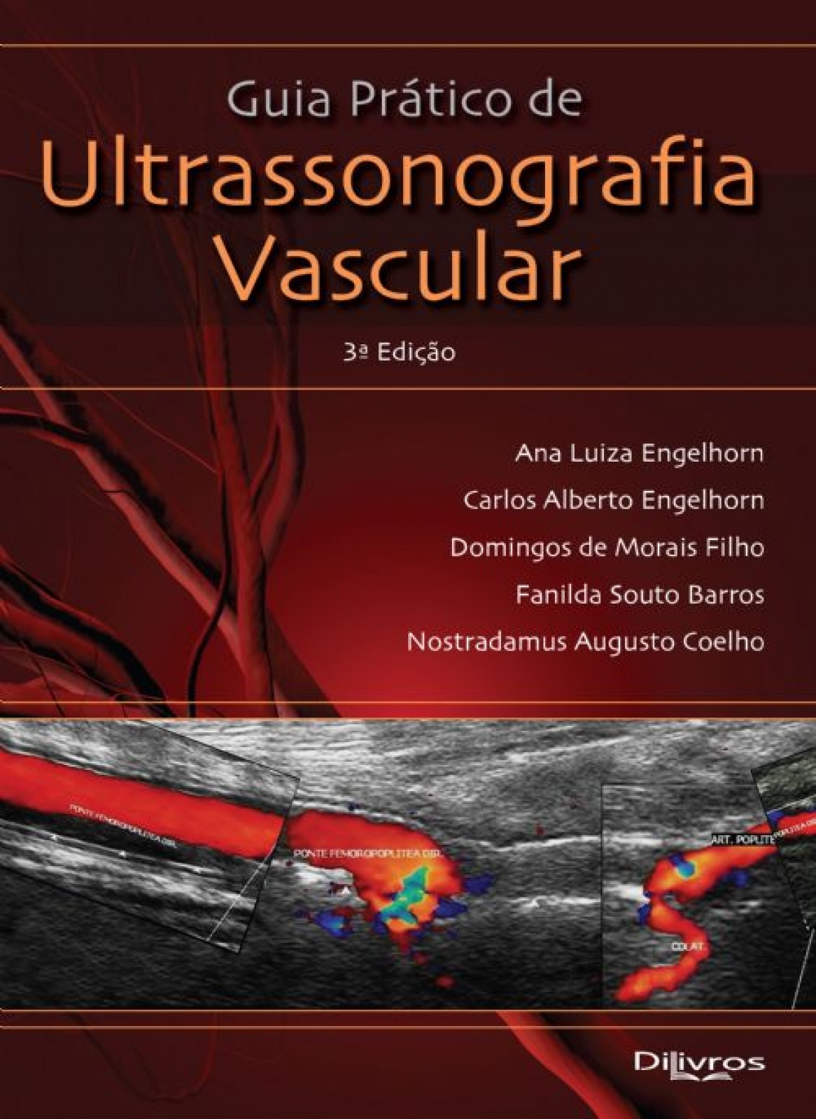 Guia Pratico De Ultrassonografia Vascular