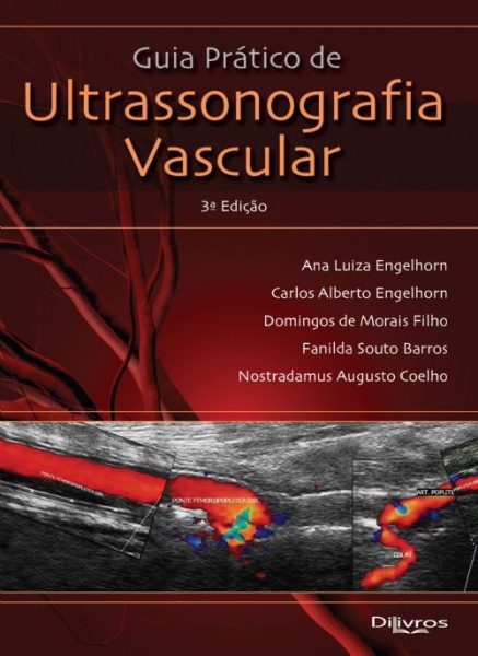 Guia Pratico De Ultrassonografia Vascular