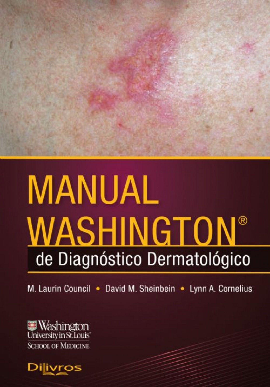 Manual Washington Diagnostico Dermatologico