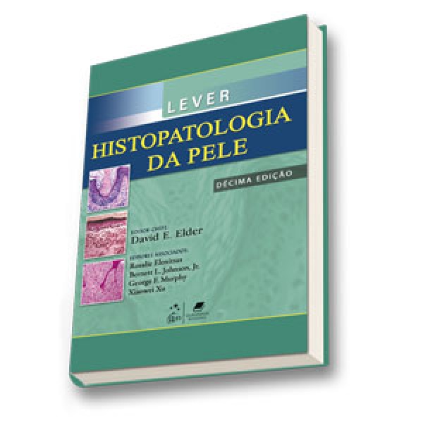 Lever - Histopatologia Da Pele