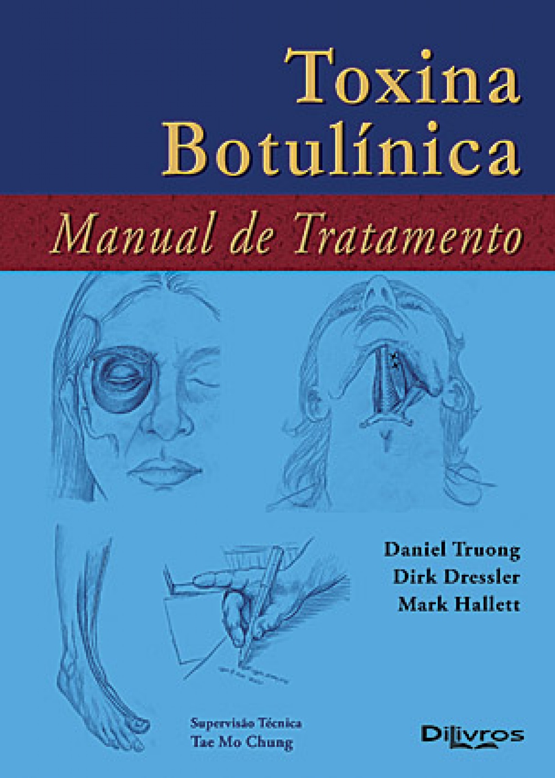 Toxina Botulinica - Manual De Tratamento