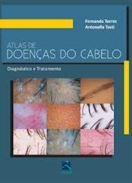 Atlas De Doenças Do Cabelo - Diagnóstico E Tratamento