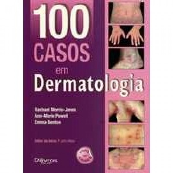 100 Casos Em Dermatologia