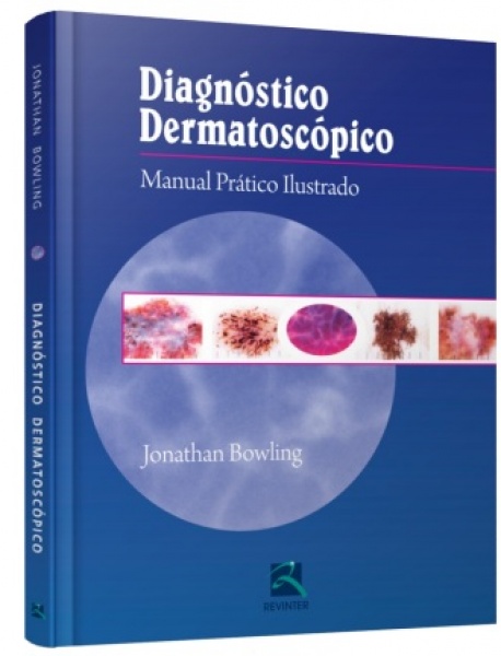 Diagnóstico Dermatoscópico  Manual Prático Ilustrado