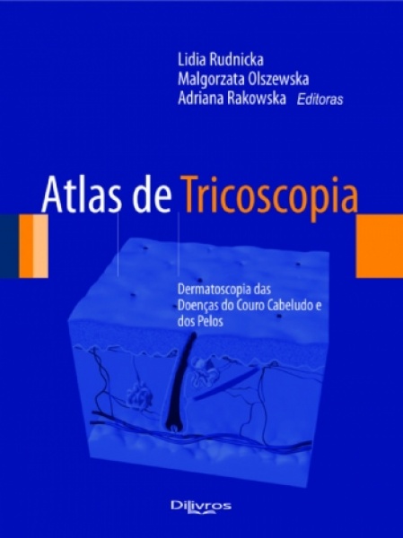 Atlas De Tricoscopia - Dermatoscopia Das Doenças Do Couro Cabeludo E Dos Pelos