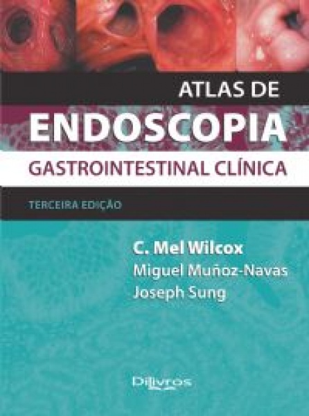Atlas De Endoscopia Gastrointenstinal Clínica
