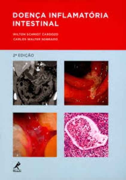 Doença Inflamatória Intestinal - 2ª Edição
