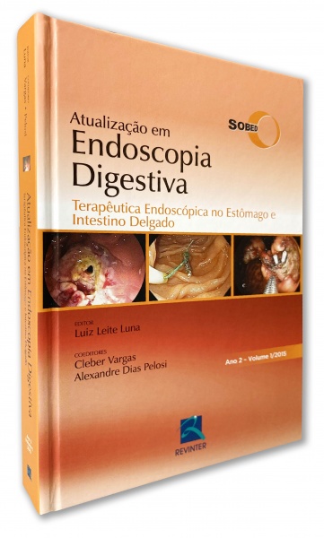 Atualização Em Endoscopia Digestiva  - Terapêutica Endoscópica No Estômago E Intestino Delgado
