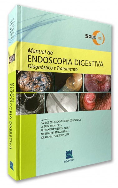 Manual De Endoscopia Digestiva – Diagnóstico E Tratamento - Sobed/rs