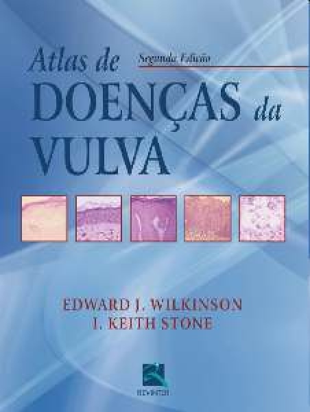 Atlas De Doenças Da Vulva
