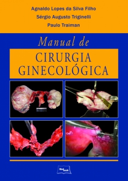 Manual De Cirurgia Ginecológica