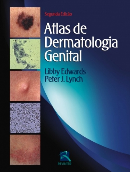 Atlas De Dermatologia Genital