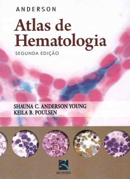 Anderson Atlas De Hematologia 2ª Edição