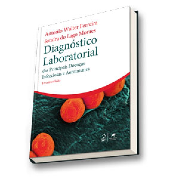 Diagnóstico Laboratorial Das Principais Doenças Infecciosas E Autoimunes
