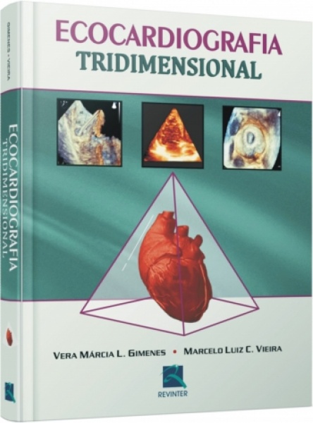 Ecocardiografia Tridimensional