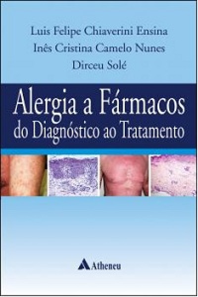 Alergia A Fármacos - Do Diagnóstico Ao Tratamento