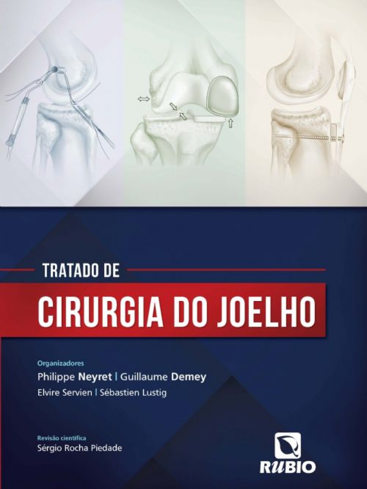 Tratado De Cirurgia Do Joelho