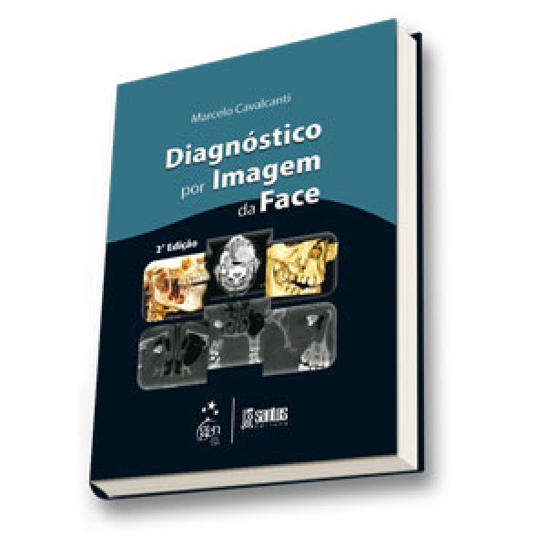 Diagnóstico Por Imagem Da Face