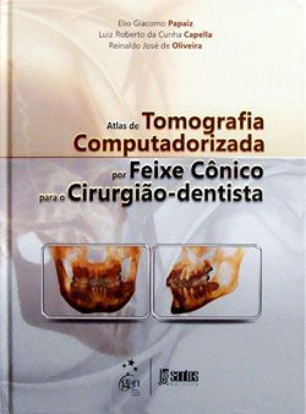 Atlas De Tomografia Computadorizada Por Feixe Cônico Para O Cirurgião-Dentista