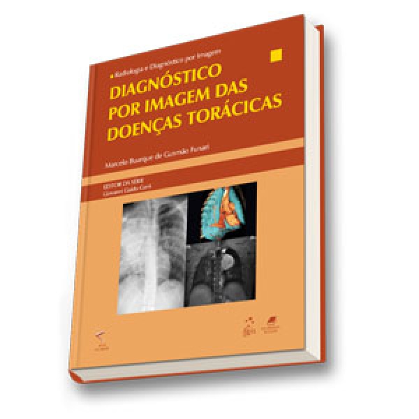 Radiologia E Diagnóstico Por Imagem - Diagnóstico Por Imagem Das Doenças Torácicas