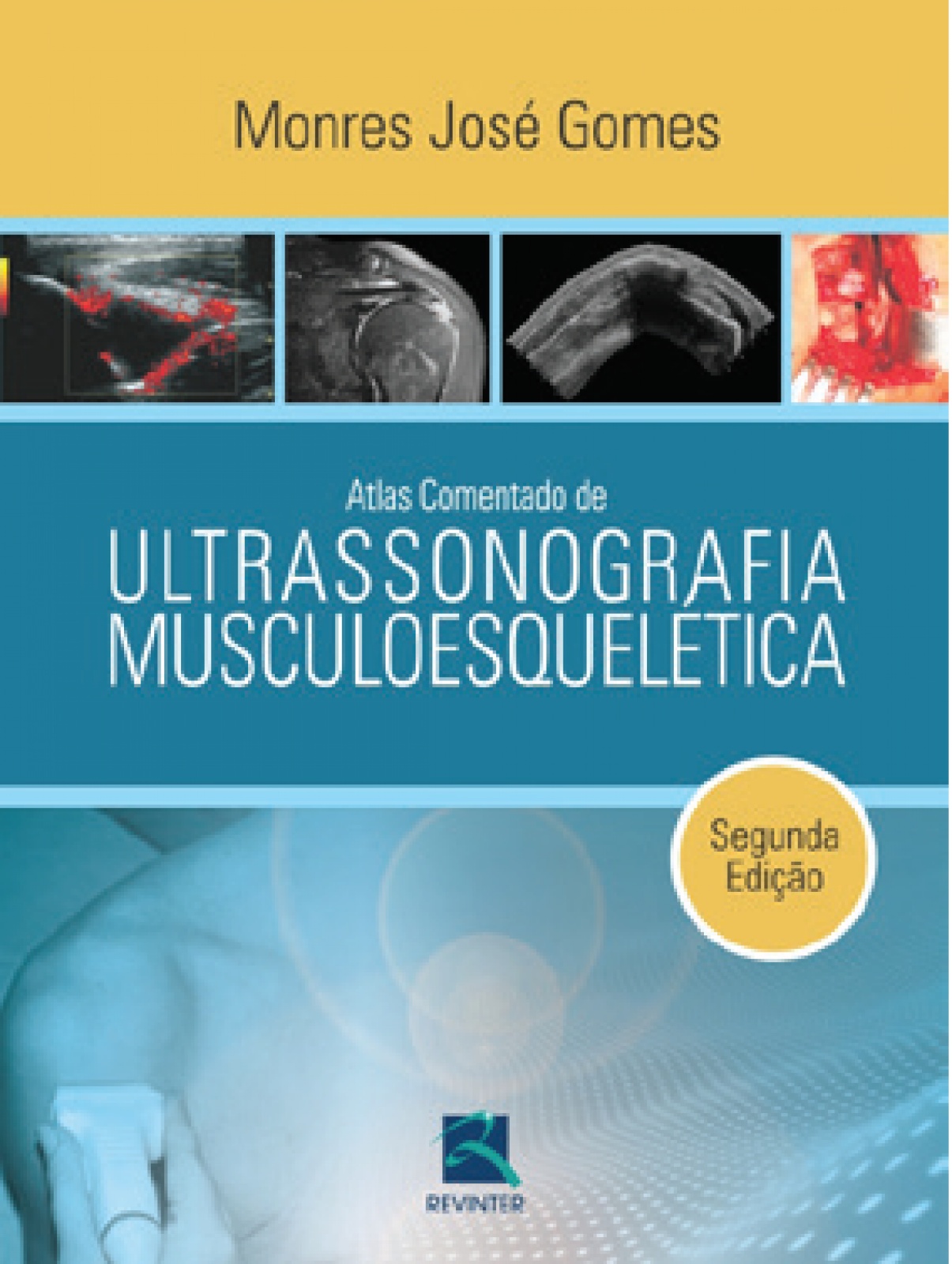 Atlas Comentado De Ultrassonografia Musculoesquelética, 2ª Edição