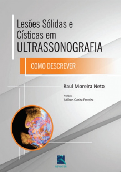 Lesões Sólidas E Císticas Em Ultrassonografia - Como Descrever
