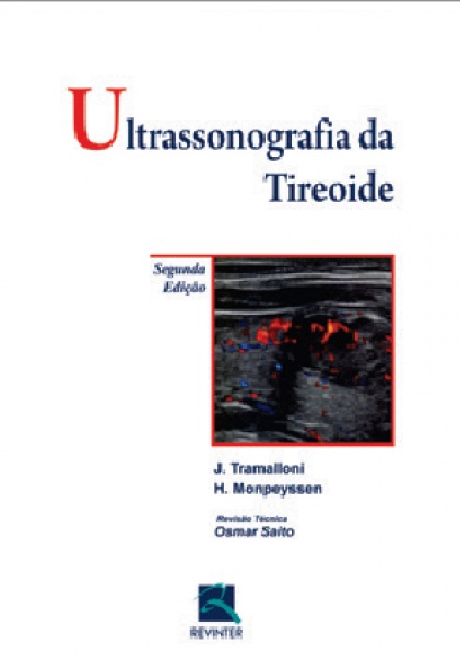 Ultrassonografia Da Tireoide, 2ª Edição