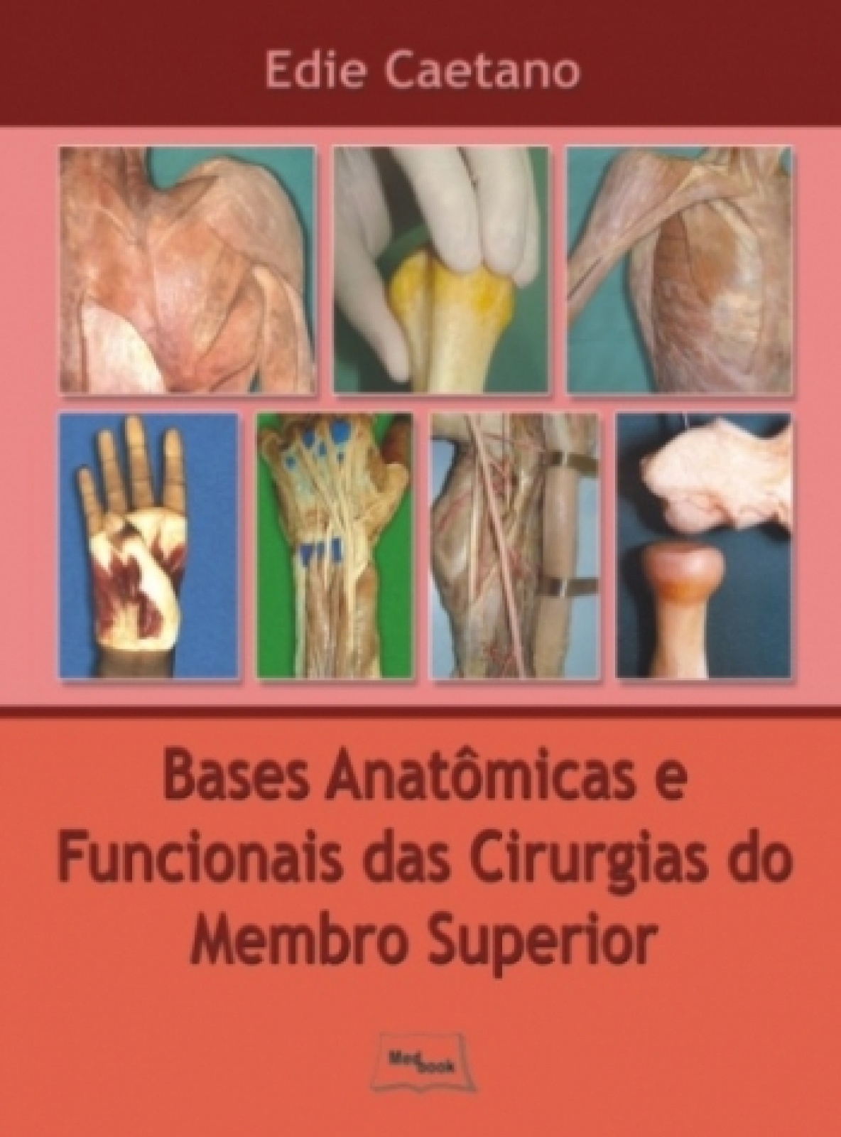 Bases Anatômicas E Funcionais Das Cirurgias Do Membro Superior
