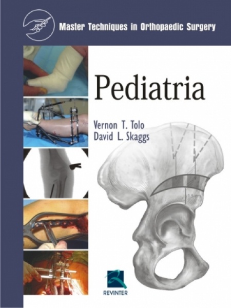 Pediatria - Master Techniques In Orthaepedic Surgery