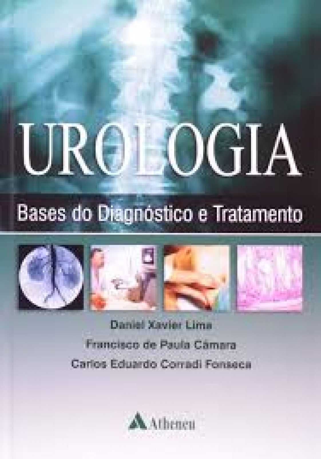 Urologia - Bases Do Diagnóstico E Tratamento