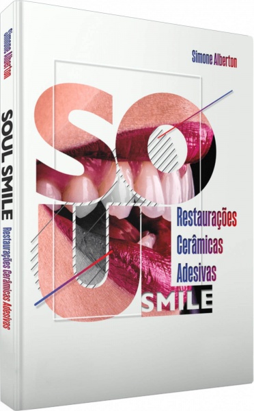 Soul Smile: Restaurações Cerâmicas Adesivas