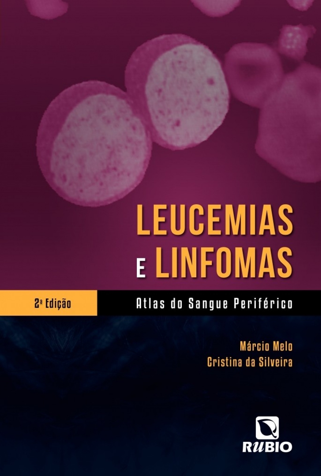 Leucemias E Linfomas - Atlas Do Sangue Periférico
