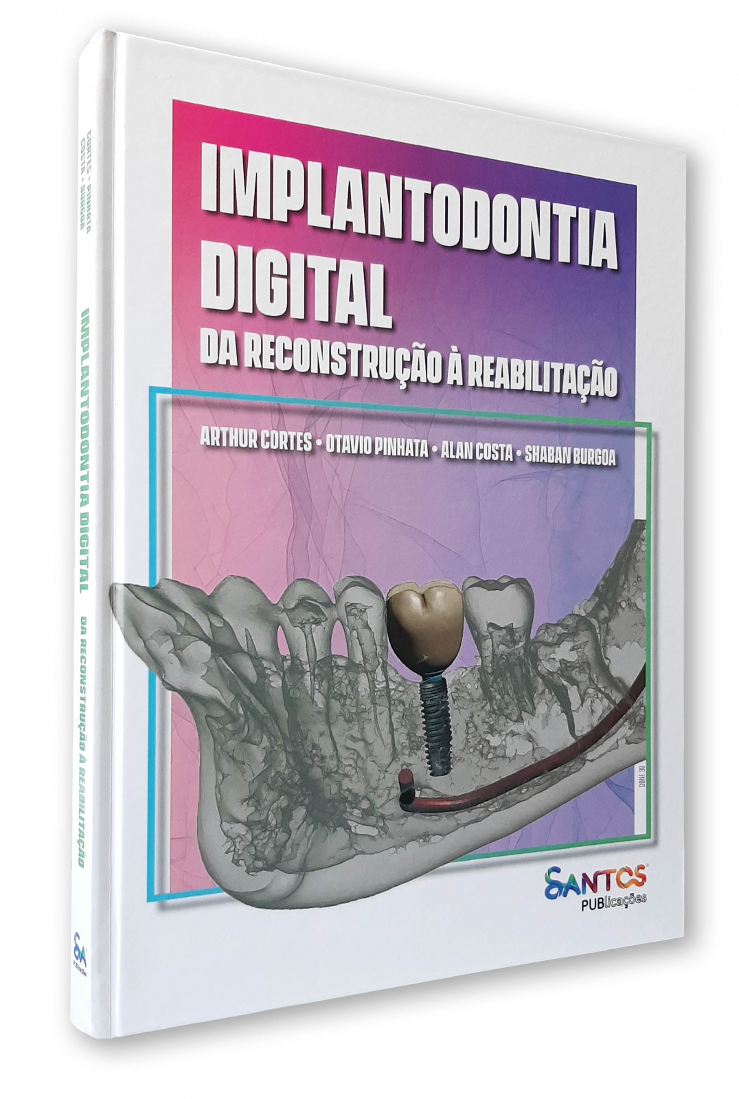 Implantodontia Digital Da Reconstrução À Reabilitação