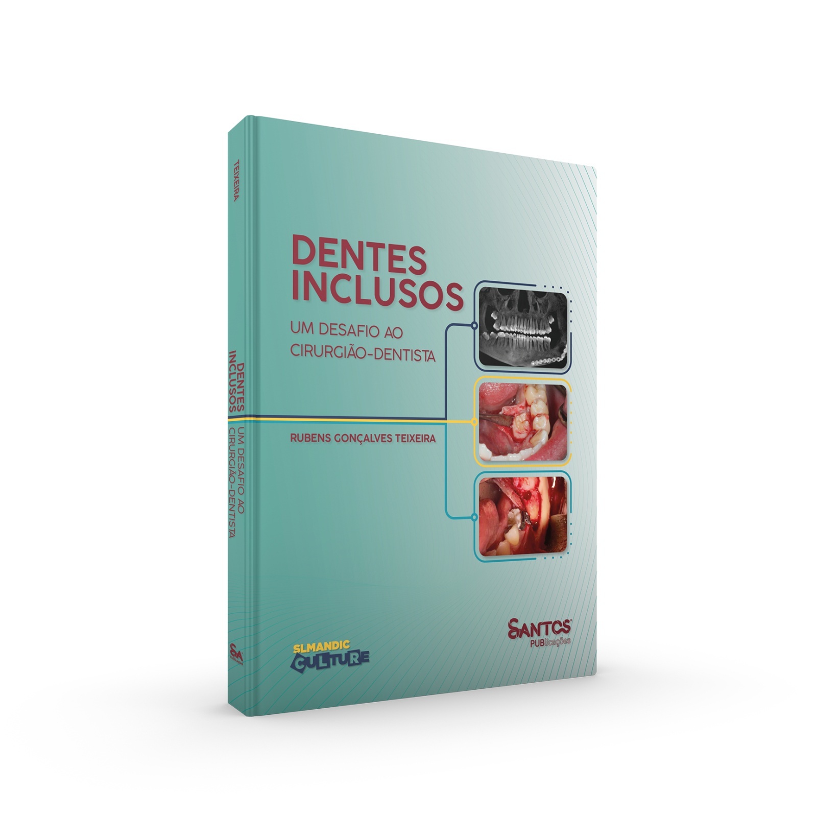 Dentes Inclusos - Um Desafio Ao Cirurgião Dentista