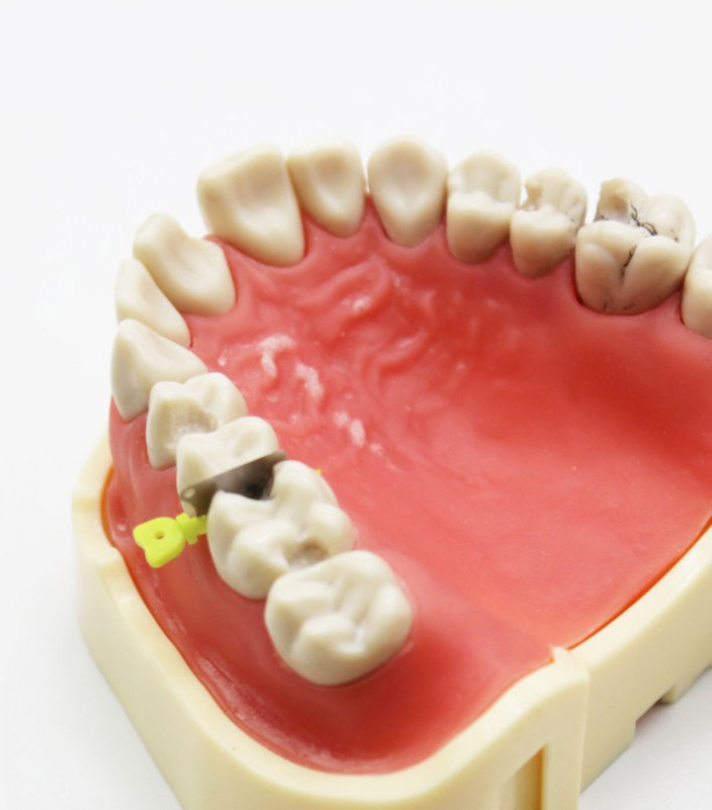 Cunha Dental Protetora - Cotisen