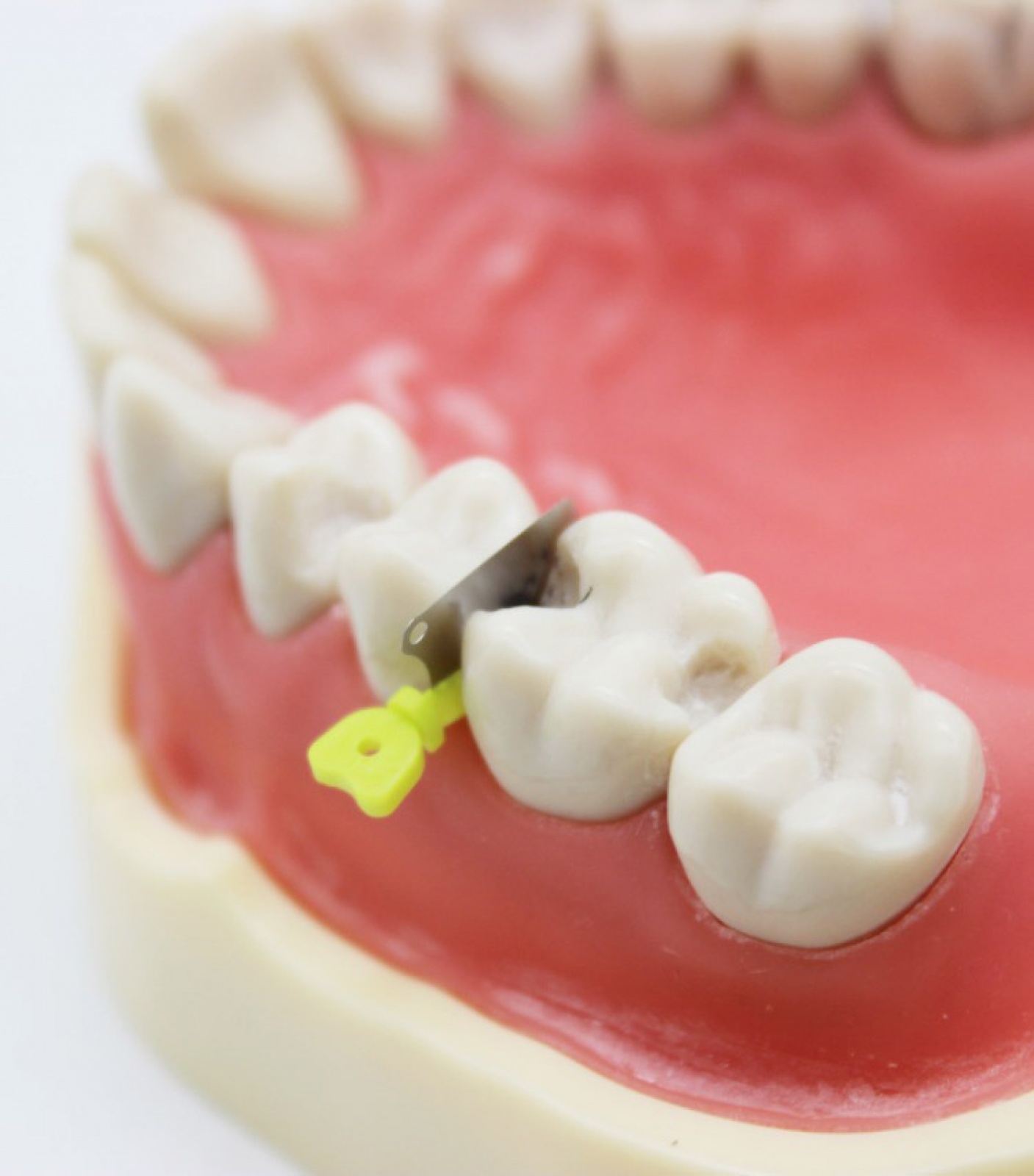 Cunha Dental Protetora - Cotisen